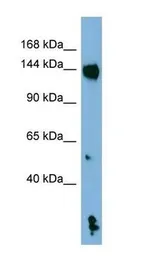 Anti-NALP1 antibody used in Western Blot (WB). GTX01082