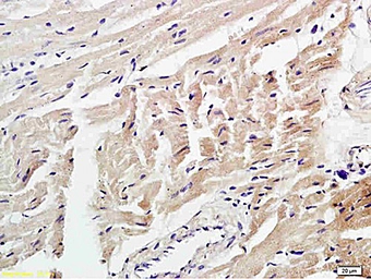 Anti-4 Hydroxynonenal antibody used in IHC (Paraffin sections) (IHC-P). GTX01087