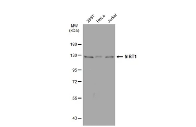 Anti-SIRT1 antibody [SZ04-01] used in Western Blot (WB). GTX01139