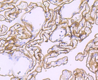 Anti-Podoplanin antibody [JM31-21] used in IHC (Paraffin sections) (IHC-P). GTX01168