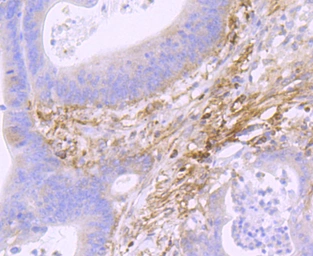 Anti-Podoplanin antibody [JM31-21] used in IHC (Paraffin sections) (IHC-P). GTX01168