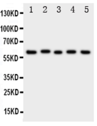 Anti-ASIC3 antibody used in Western Blot (WB). GTX01177