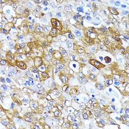 Anti-ATG7 antibody [GT1218] used in IHC (Paraffin sections) (IHC-P). GTX01526