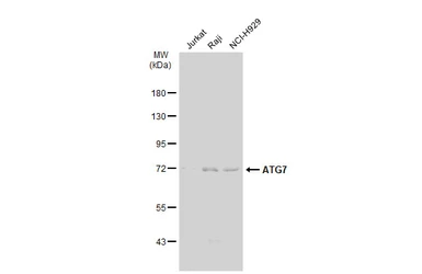Anti-ATG7 antibody [GT1218] used in Western Blot (WB). GTX01526