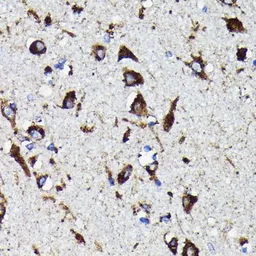 Anti-Cathepsin D antibody [GT1232] used in IHC (Paraffin sections) (IHC-P). GTX01540