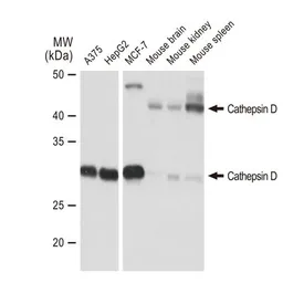 Anti-Cathepsin D antibody [GT1232] used in Western Blot (WB). GTX01540