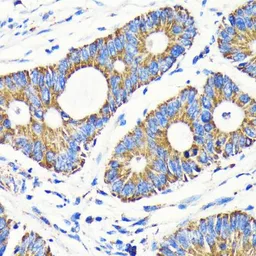 Anti-VDAC1 antibody [GT1235] used in IHC (Paraffin sections) (IHC-P). GTX01543