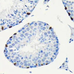 Anti-SOX9 antibody [GT1219] used in IHC (Paraffin sections) (IHC-P). GTX01545