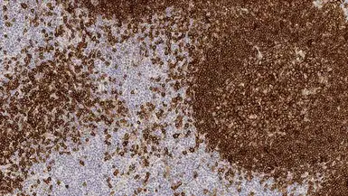 Anti-CD19 antibody [BT51E] used in IHC (Paraffin sections) (IHC-P). GTX01851