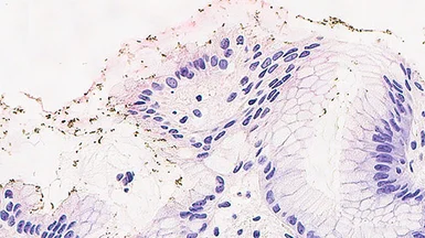 Anti-Helicobacter pylori antibody [ULC3R] used in IHC (Paraffin sections) (IHC-P). GTX01855