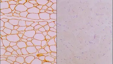 Anti-Laminin alpha 2 antibody [Mer3/22B2] used in IHC (Frozen sections) (IHC-Fr). GTX01902