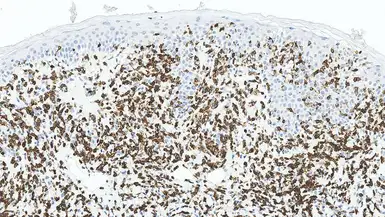 Anti-CD3 antibody [LN10] used in IHC (Paraffin sections) (IHC-P). GTX01936