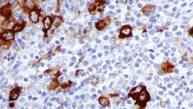 Anti-Fascin 1 antibody [IM20] used in IHC (Paraffin sections) (IHC-P). GTX01968