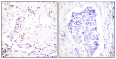 Anti-Cyclin A1 antibody used in IHC (Paraffin sections) (IHC-P). GTX02524