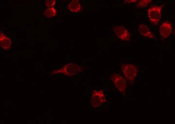 Anti-Smoothened homolog antibody used in Immunocytochemistry/ Immunofluorescence (ICC/IF). GTX02530