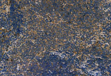 Anti-Smoothened homolog antibody used in IHC (Paraffin sections) (IHC-P). GTX02530