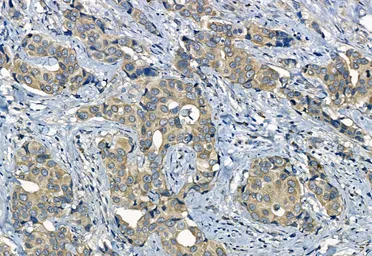 Anti-Smoothened homolog antibody used in IHC (Paraffin sections) (IHC-P). GTX02530