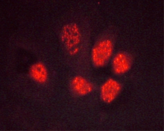 Anti-PPAR gamma (phospho Ser112) antibody used in Immunocytochemistry/ Immunofluorescence (ICC/IF). GTX02531