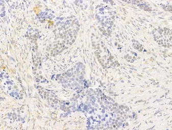Anti-PPAR gamma (phospho Ser112) antibody used in IHC (Paraffin sections) (IHC-P). GTX02531