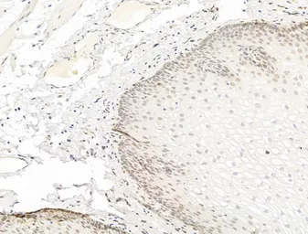 Anti-PPAR gamma (phospho Ser112) antibody used in IHC (Paraffin sections) (IHC-P). GTX02531