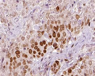 Anti-REV3L antibody used in IHC (Paraffin sections) (IHC-P). GTX02533