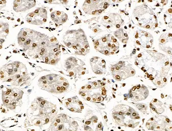 Anti-Histone H3K9K14K23K27ac (Acetyl Lys9/Lys14/Lys23/Lys27) antibody used in IHC (Paraffin sections) (IHC-P). GTX02535