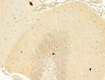 Anti-alpha Synuclein (phospho Ser129) antibody used in IHC (Paraffin sections) (IHC-P). GTX02537
