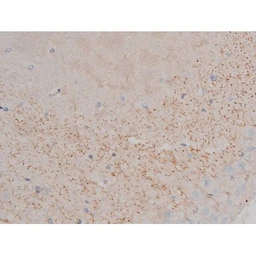 Anti-alpha Synuclein (phospho Ser129) antibody used in IHC (Paraffin sections) (IHC-P). GTX02537