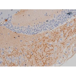 Anti-alpha Synuclein (phospho Ser129) antibody used in IHC (Paraffin sections) (IHC-P). GTX02537