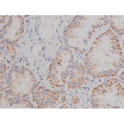 Anti-alpha Synuclein (phospho Ser129) antibody used in IHC (Paraffin sections) (IHC-P). GTX02537
