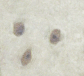 Anti-alpha Synuclein (phospho Ser129) antibody used in IHC (Paraffin sections) (IHC-P). GTX02537
