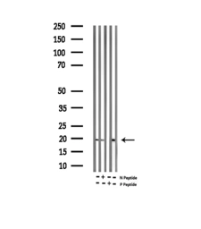 Anti-alpha Synuclein (phospho Ser129) antibody used in Western Blot (WB). GTX02537