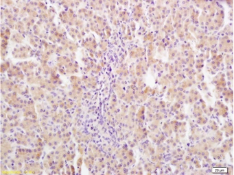 Anti-Growth hormone Receptor antibody used in IHC (Paraffin sections) (IHC-P). GTX02538