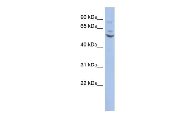 Anti-ER81 antibody used in Western Blot (WB). GTX02562