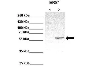 Anti-ER81 antibody used in Western Blot (WB). GTX02562