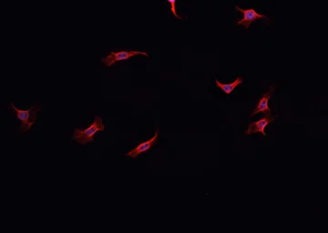 Anti-NOX1 antibody used in Immunocytochemistry/ Immunofluorescence (ICC/IF). GTX02577