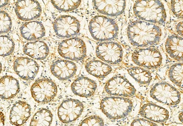Anti-PLCE1 antibody used in IHC (Paraffin sections) (IHC-P). GTX02580