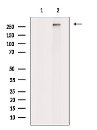 Anti-PLCE1 antibody used in Western Blot (WB). GTX02580