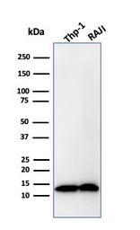 Anti-beta 2 Microglobulin antibody [B2M/1857R] used in Western Blot (WB). GTX02596