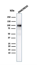Anti-GP2 antibody [GP2/3134R] used in Western Blot (WB). GTX02646