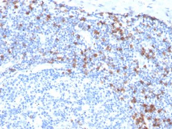Anti-Integrin alpha E antibody [ITGAE/3904R] used in IHC (Paraffin sections) (IHC-P). GTX02653
