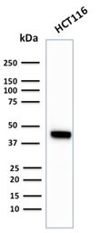 Anti-Cytokeratin 18 antibody [KRT18/2819R] used in Western Blot (WB). GTX02658