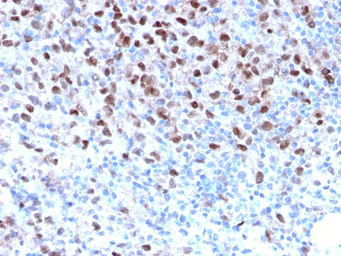 Anti-MITF antibody [MITF/2987R] used in IHC (Paraffin sections) (IHC-P). GTX02674