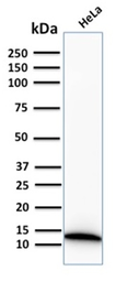 Anti-S100A4 antibody [S100A4/2750R] used in Western Blot (WB). GTX02703