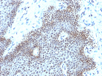 Anti-SOX11 antibody [SOX11/3235R] used in IHC (Paraffin sections) (IHC-P). GTX02709