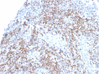 Anti-ZAP70 antibody [ZAP70/3921R] used in IHC (Paraffin sections) (IHC-P). GTX02745