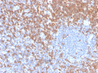 Anti-ZAP70 antibody [ZAP70/4040R] used in IHC (Paraffin sections) (IHC-P). GTX02746