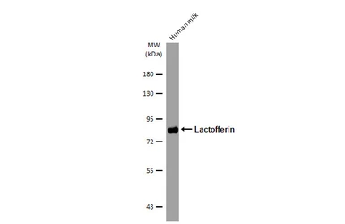 Anti-Lactofferin antibody [2-18-1] used in Western Blot (WB). GTX02809