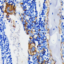 Anti-Integrin beta 3 antibody [GT1226] used in IHC (Paraffin sections) (IHC-P). GTX02823