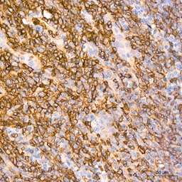 Anti-GluT1 antibody [GT1235] used in IHC (Paraffin sections) (IHC-P). GTX02832
